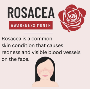 fce4f8985d480e639c1df0ed6682d2ad