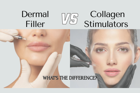 Dermal Filler vs Collagen Stimulator